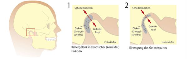 Kiefergelenk - Dr. Dr. Wolf